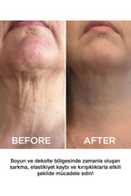 Sıkılaştırıcı Boyun Kremi 50ml | Lifting & Nemlendirici Bakım